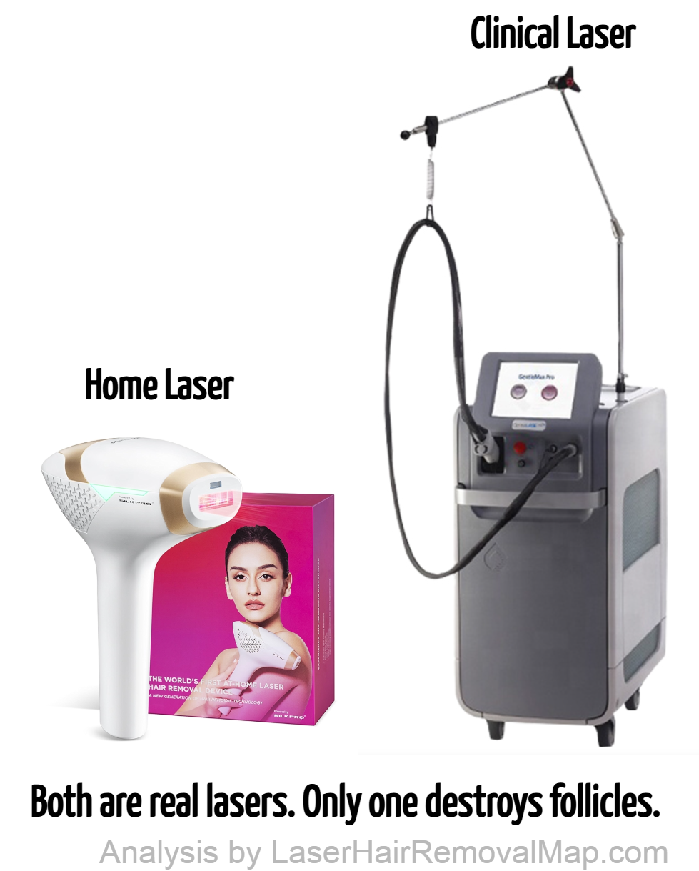 Home laser vs clinical laser comparison: Tria Hair Removal Laser 4X (home device, Class 1) next to Candela GentleMax Pro (clinical laser, Class IV). Both are real lasers, but the clinical device delivers roughly 100 times more energy per pulse.